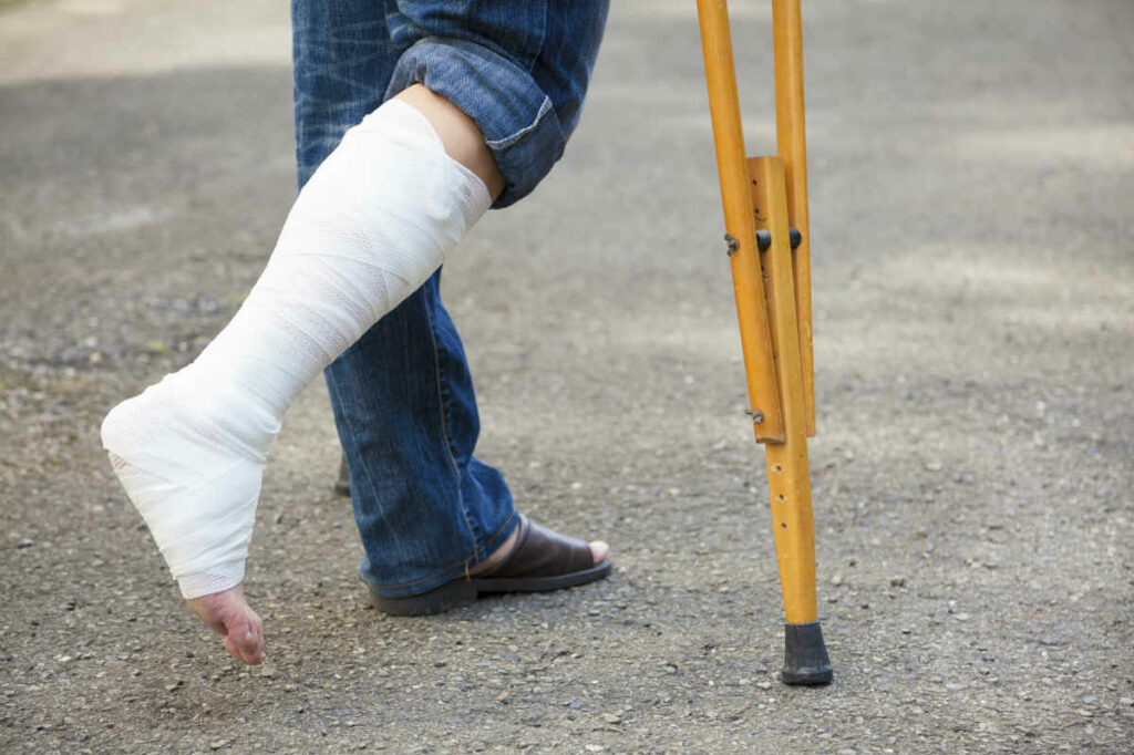 Ankle Injury Accompanied by a Knee Injury